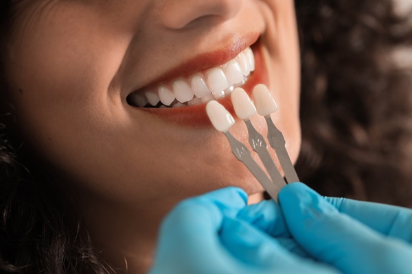 How Long Do Veneers Last? Tips For Maintaining Your New Smile